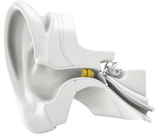 Das unsichtbare Hörgerät Lyric wird direkt im Gehörgang platziert.